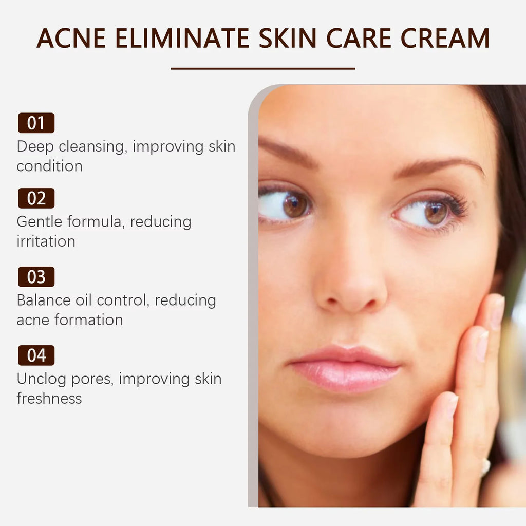 Oil-Control Pimple & Acne Repair Face Cream