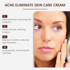 Oil-Control Pimple & Acne Repair Face Cream