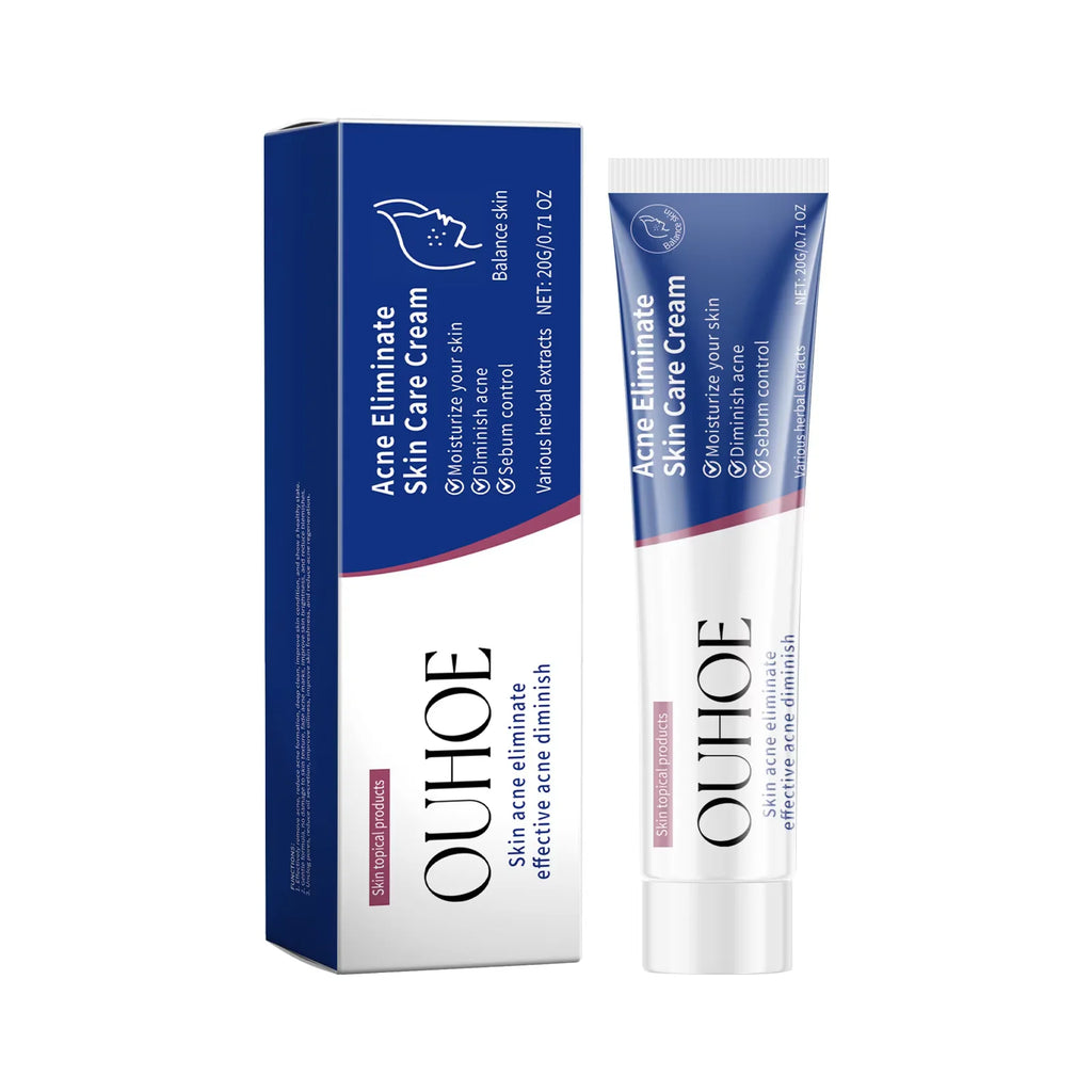 Oil-Control Pimple & Acne Repair Face Cream