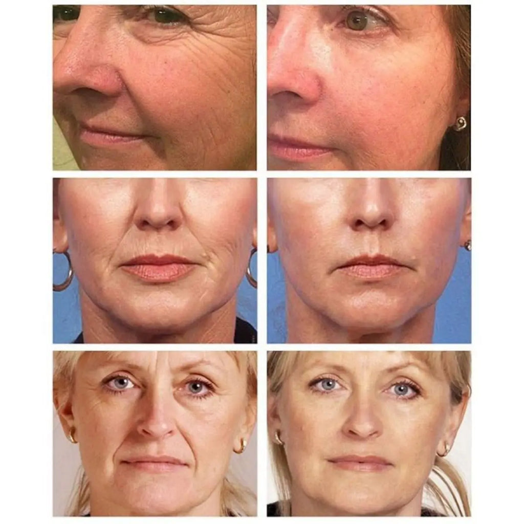 Retinol Anti-Aging & Wrinkle Lifting Face Cream