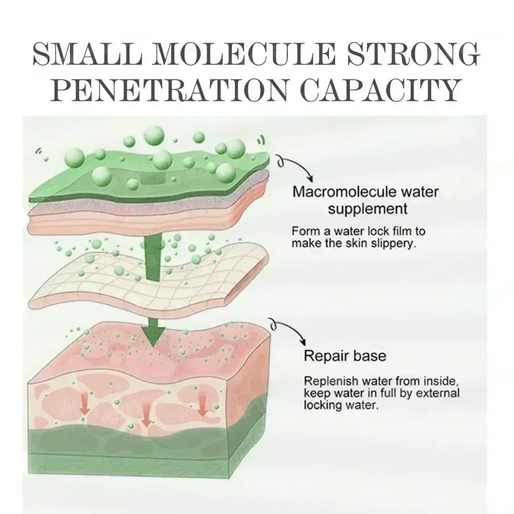 Severe Acne & Cystic Pimple Treatment Cream