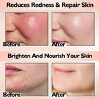 Korean Redness Relief Cream for Sensitive Skin & Rosacea