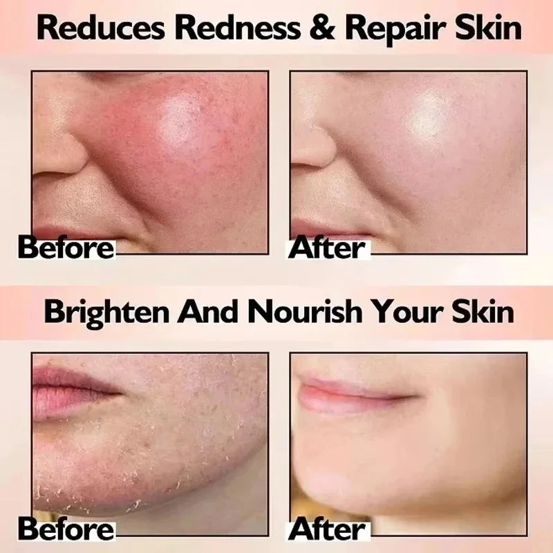 Korean Redness Relief Cream for Sensitive Skin & Rosacea