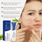 Oil-Control Pimple & Acne Repair Face Cream