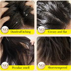 Natural Honey Essence Shampoo for Dandruff Relief