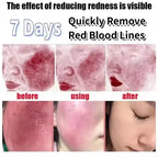 Korean Redness Relief Cream for Sensitive Skin & Rosacea
