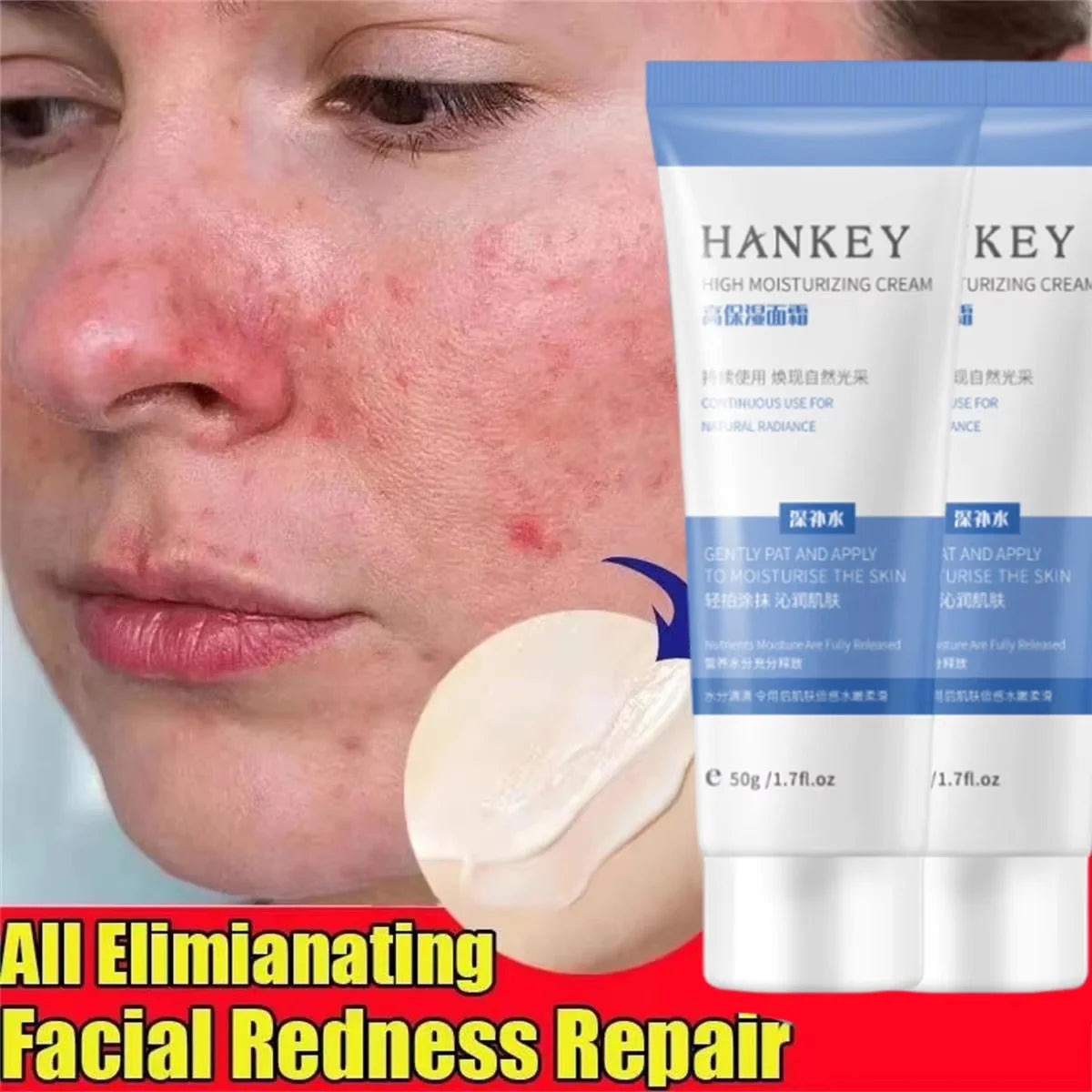 Korean Redness Relief Cream for Sensitive Skin & Rosacea