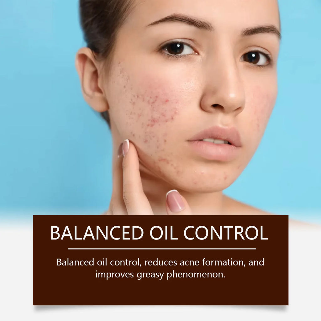 Oil-Control Pimple & Acne Repair Face Cream