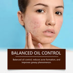 Oil-Control Pimple & Acne Repair Face Cream
