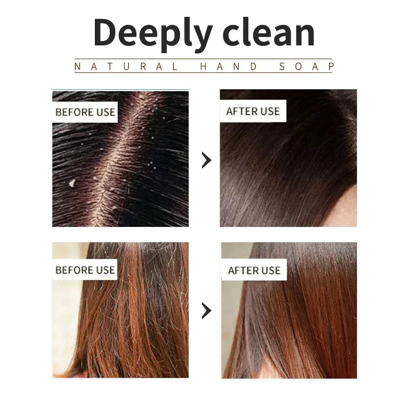 Silicone-Free Lavender Shampoo for Oily Scalp